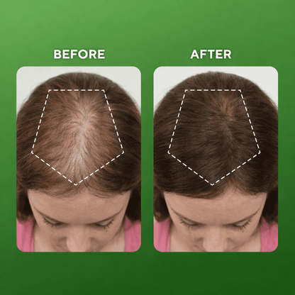 Bionplex Hair Growth Serum
